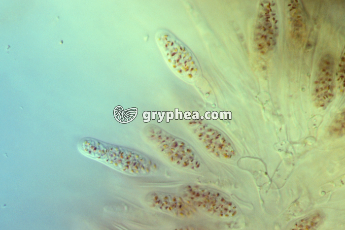 Fucus vésiculeux - anthéridies remplies d'anthérozoïdes x100 - gryphea.com